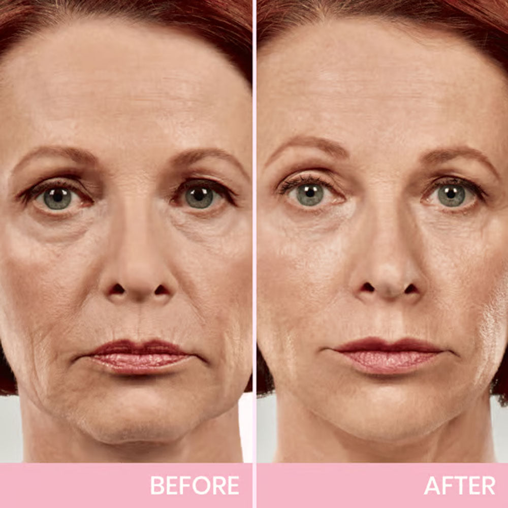 Liftella™ – Instant V Face Lifting Tape